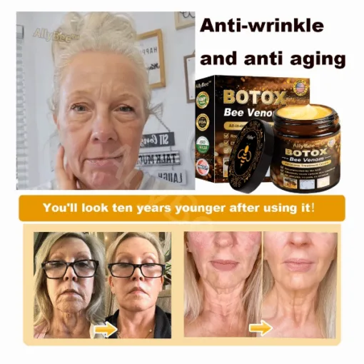 AllyBee™ Botox Bee Venom Wrinkle Removal Cream