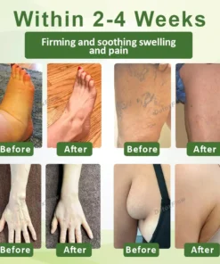 DetoxFlow™ SwellSoothe Lymphatic Cream