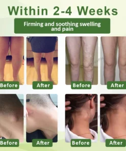 DetoxFlow™ SwellSoothe Lymphatic Cream