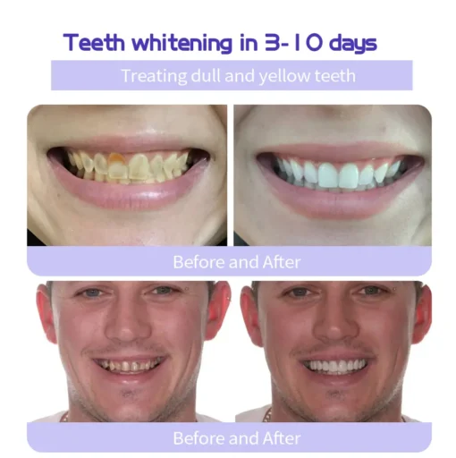 GarageLine™ Teeth Restoration Mineral Powder - Image 10