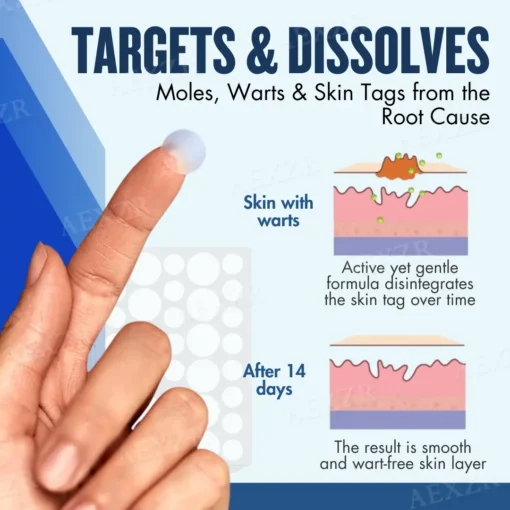 Skinetiv™ Moles & Warts Removing Skin Tag Patch