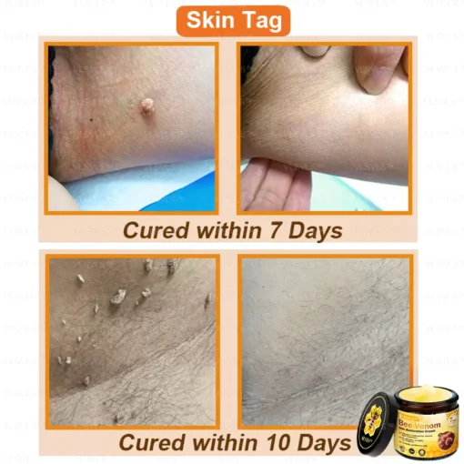 VLSVLS™ Bee Venom Skin Restoration Cream - Image 3