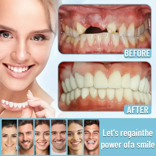 Ceoerty™ Official Store Advanced Full Denture Set