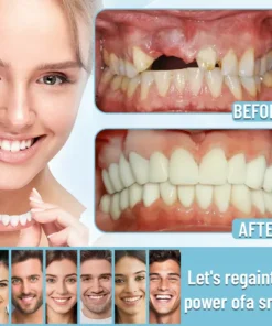 【Ceoerty™ Official Store】🦷Advanced Full Denture Set ⏳Limited-Time 30-Minute Discount!⏳