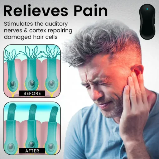 Ceoerty™ Tinnitus Relief Device Serenity