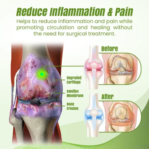 Ceoerty® ReLaxaJoint Therapy Gel