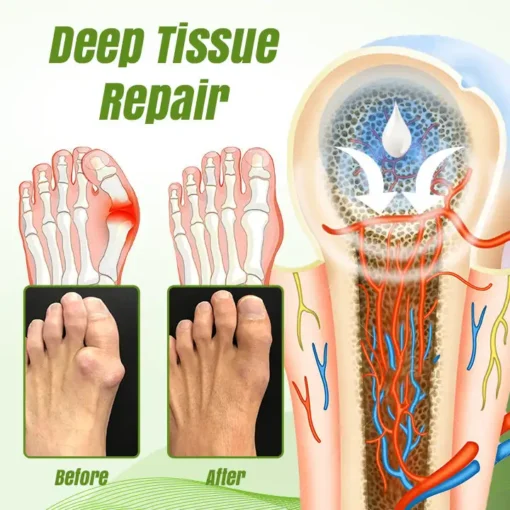 Ceoerty® ReLaxaJoint Therapy Gel
