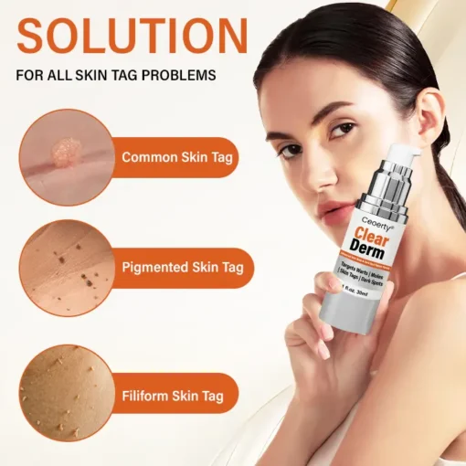 Ceoerty® ClearDerm Advanced Wart Mole & Dark Spot Repair Serum
