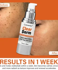 Ceoerty® ClearDerm Advanced Wart Mole & Dark Spot Repair Serum