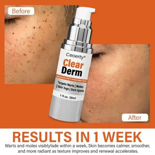 Ceoerty® ClearDerm Advanced Wart Mole & Dark Spot Repair Serum