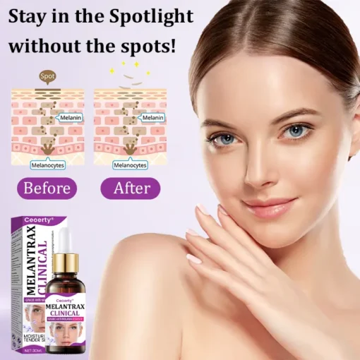 Ceoerty® MelantraX Clinical-Grade Anti-Melanin Essence
