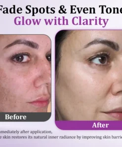 Ceoerty® MelantraX Clinical-Grade Anti-Melanin Essence