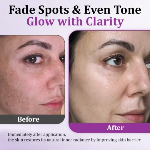 Ceoerty® MelantraX Clinical-Grade Anti-Melanin Essence