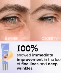 Ceoerty® InstaLift Eye Tightener