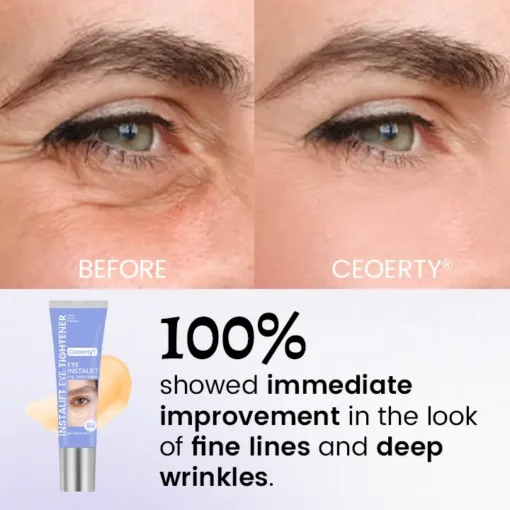 Ceoerty® InstaLift Eye Tightener
