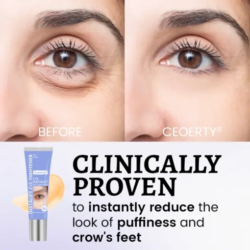 Ceoerty® InstaLift Eye Tightener