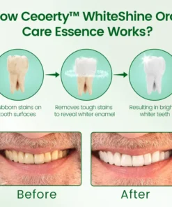 Ceoerty™ WhiteShine Oral Care Essence