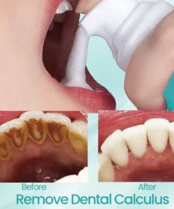 Ceoerty® RadiantSmile Oral Rinse