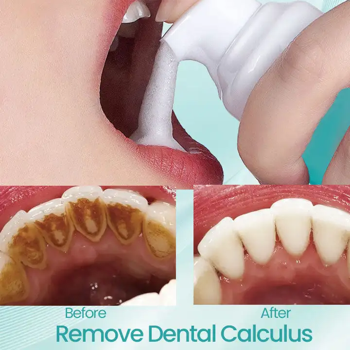 Ceoerty® RadiantSmile Oral Rinse