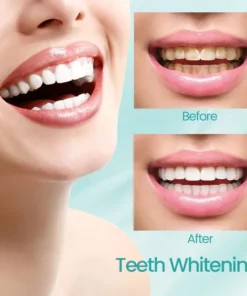 Ceoerty® RadiantSmile Oral Rinse