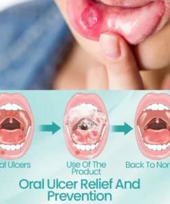 Ceoerty® RadiantSmile Oral Rinse