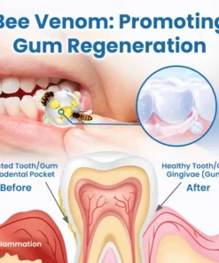 Ceoerty® RevitaDent Bee Venom Oral Treatment Powder
