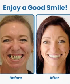 Ceoerty® RevitaDent Bee Venom Oral Treatment Powder