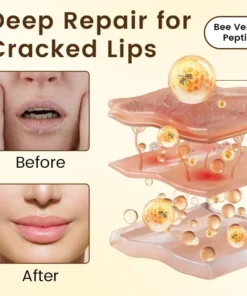 Ceoerty® BeeLixir Lip Repair Balm