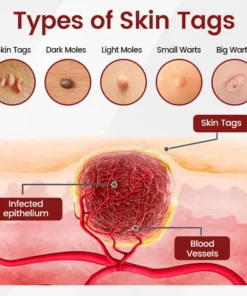 Ceoerty® KeraErase Black Rice Renewal Ampoule