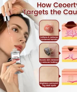 Ceoerty® KeraErase Black Rice Renewal Ampoule