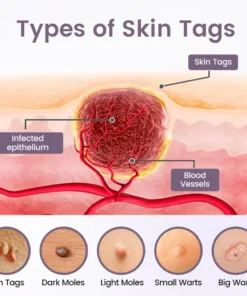 Ceoerty® WartSmooth Renewal Serum