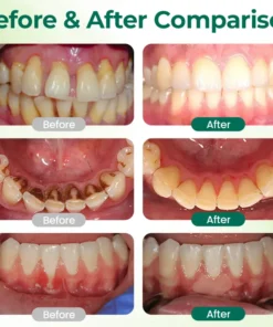 Ceoerty® Zero-Waste Mouth Tabs