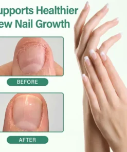 Ceoerty® Nail Detox Penetration Serum Pen