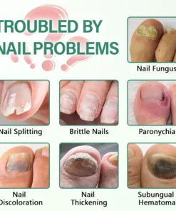 Ceoerty® Nail Detox Penetration Serum Pen