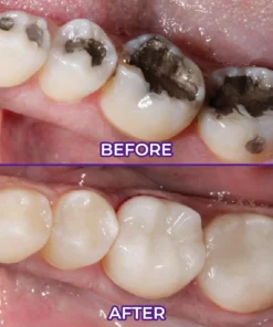 Ceoerty® VioletX Advanced Whitening Complex