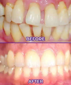 Ceoerty® VioletX Advanced Whitening Complex
