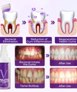 Ceoerty® VioletX Advanced Whitening Complex