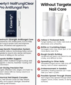 Ceoerty® NailFungiClear Pro Antifungal Pen
