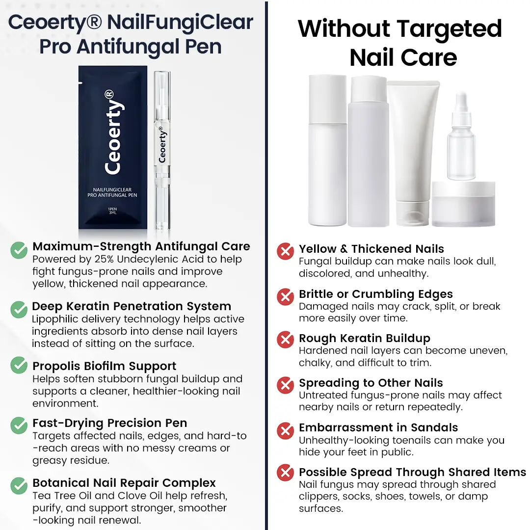 Ceoerty® NailFungiClear Pro Antifungal Pen