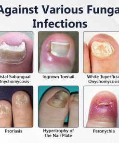 Ceoerty® NailFungiClear Pro Antifungal Pen