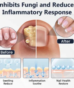 Ceoerty® NailFungiClear Pro Antifungal Pen