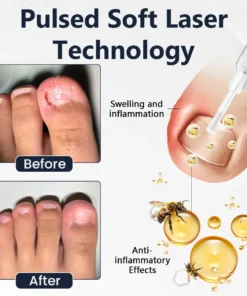 Ceoerty® NailFungiClear Pro Antifungal Pen