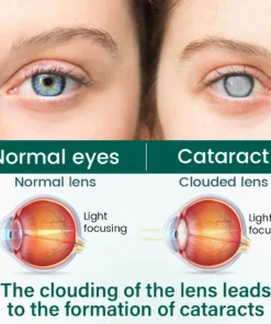 Ceoerty® OptiClear Nano Eye Roller Serum
