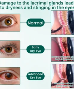 Ceoerty® OptiClear Nano Eye Roller Serum