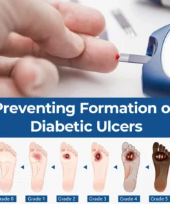Ceoerty® PureFoot Diabetes Treatment Stick