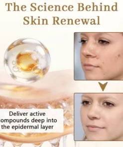 Ceoerty® KeraClear Pro Multi-Action Renewal Cream