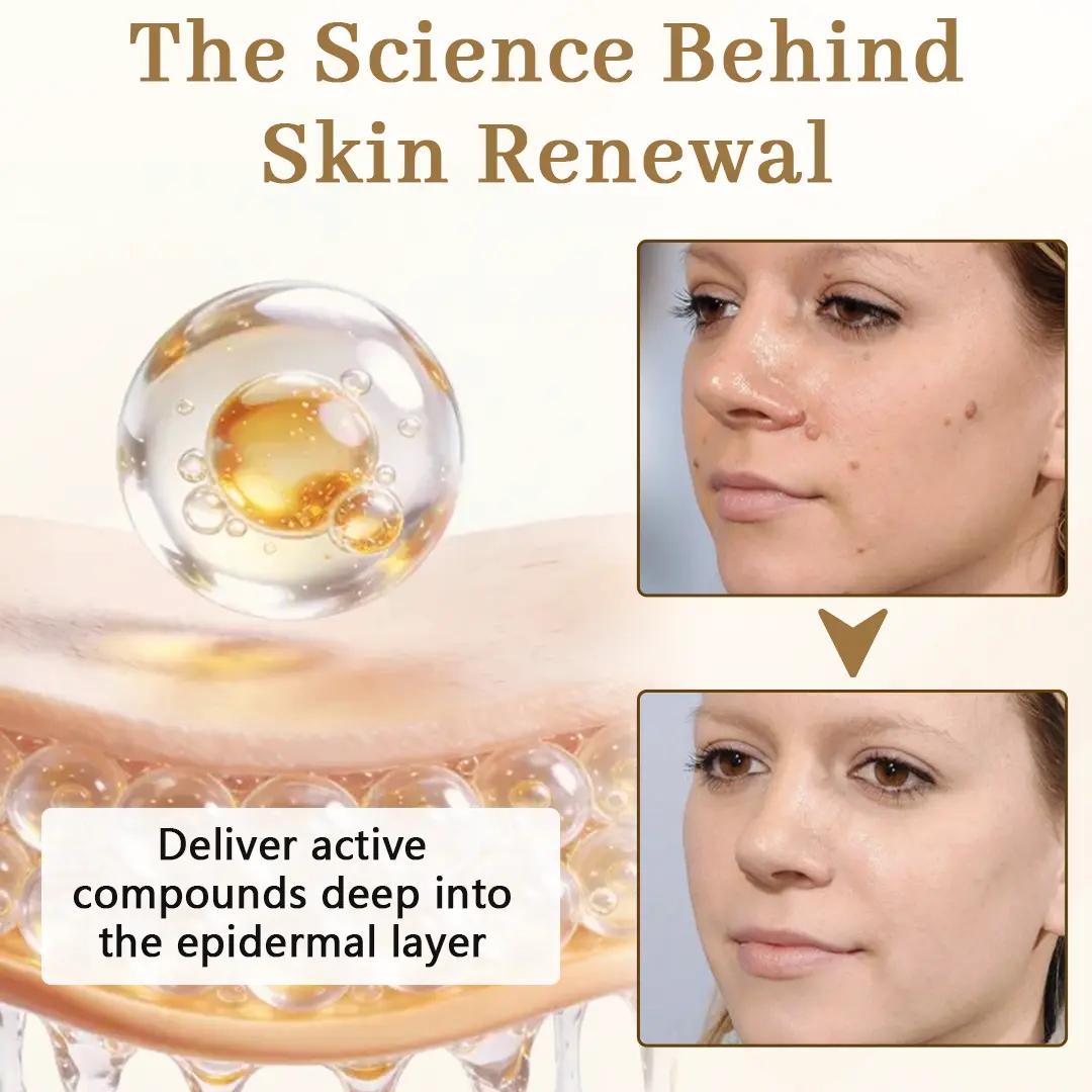 Ceoerty® KeraClear Pro Multi-Action Renewal Cream