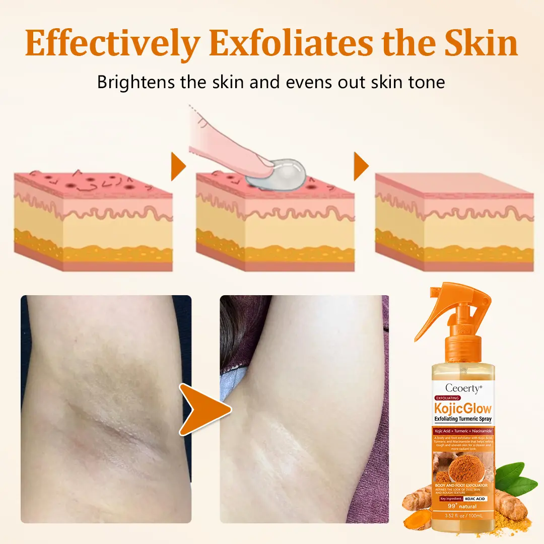 Ceoerty® KojicGlow Exfoliating Turmeric Spray
