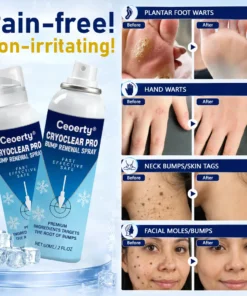 Ceoerty® CryoClear Pro Bump Renewal Spray