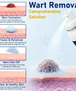 Ceoerty® CryoClear Pro Bump Renewal Spray